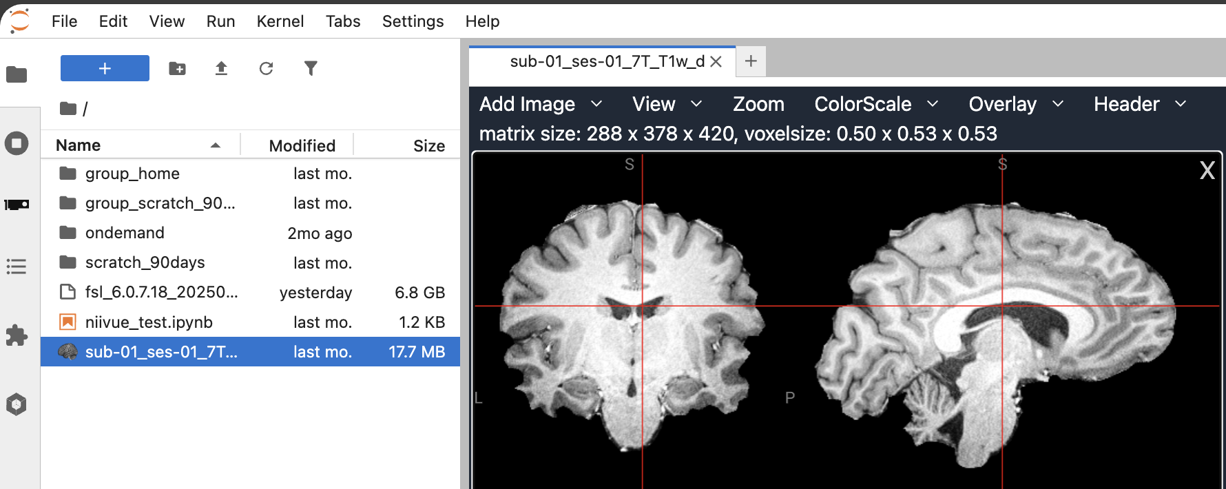 JupyterLab niivue screenshot