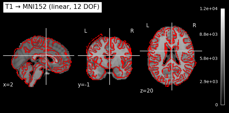 ../../_images/0b75adb211088dc26194ea43b763a8ca88e5a197ecadd25e8a3e6f6b326b16e8.png