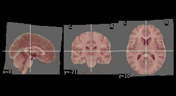 ../../_images/4a3112adbb4aa186467e3d19c447c66591688ca69f10da7e9aae8dc808496286.png