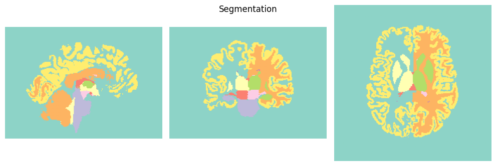 ../../_images/a601cd78acc777892b9e73269a3828962748f6f242a355c90f46aa97863d3c34.png