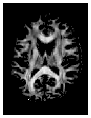 ../../_images/d5069f4c1d8cedbb9a68cfb8bc3f0194bed6bd26fcd04b8bdd7ebc6a78723369.png