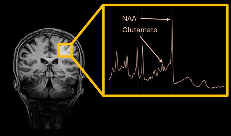 MRS spectrum overview