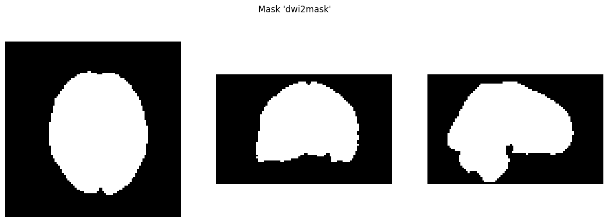 <Figure size 1500x500 with 3 Axes>