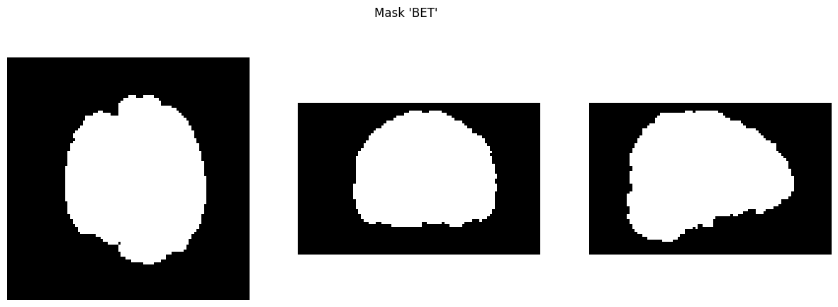 <Figure size 1500x500 with 3 Axes>
