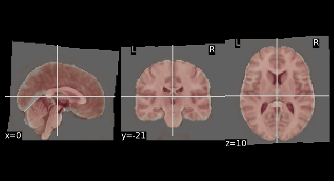 <Figure size 660x350 with 4 Axes>