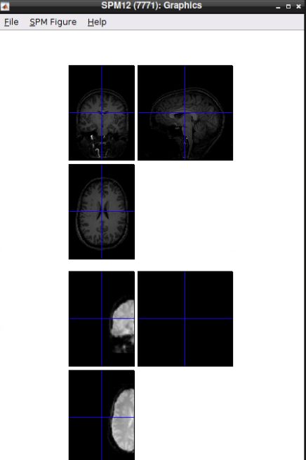 Anatomical and functional images before preprocessing