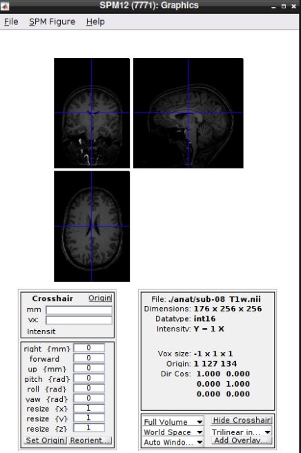 Subject 08 anatomy in SPM Display
