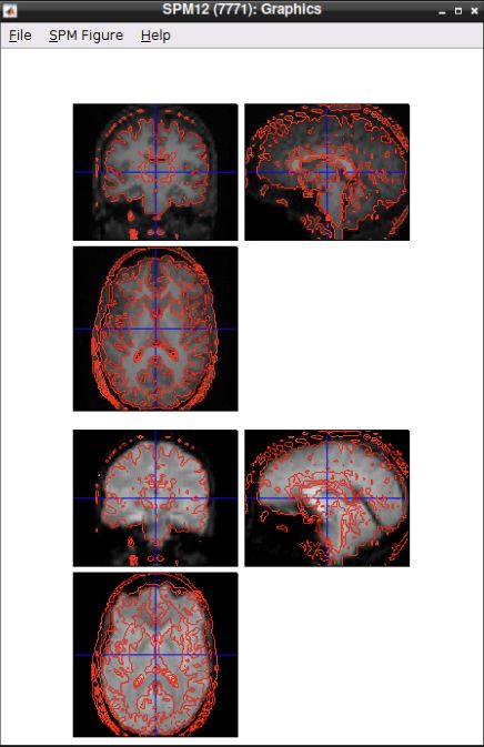 Coregistered anatomy and mean functional image with contours