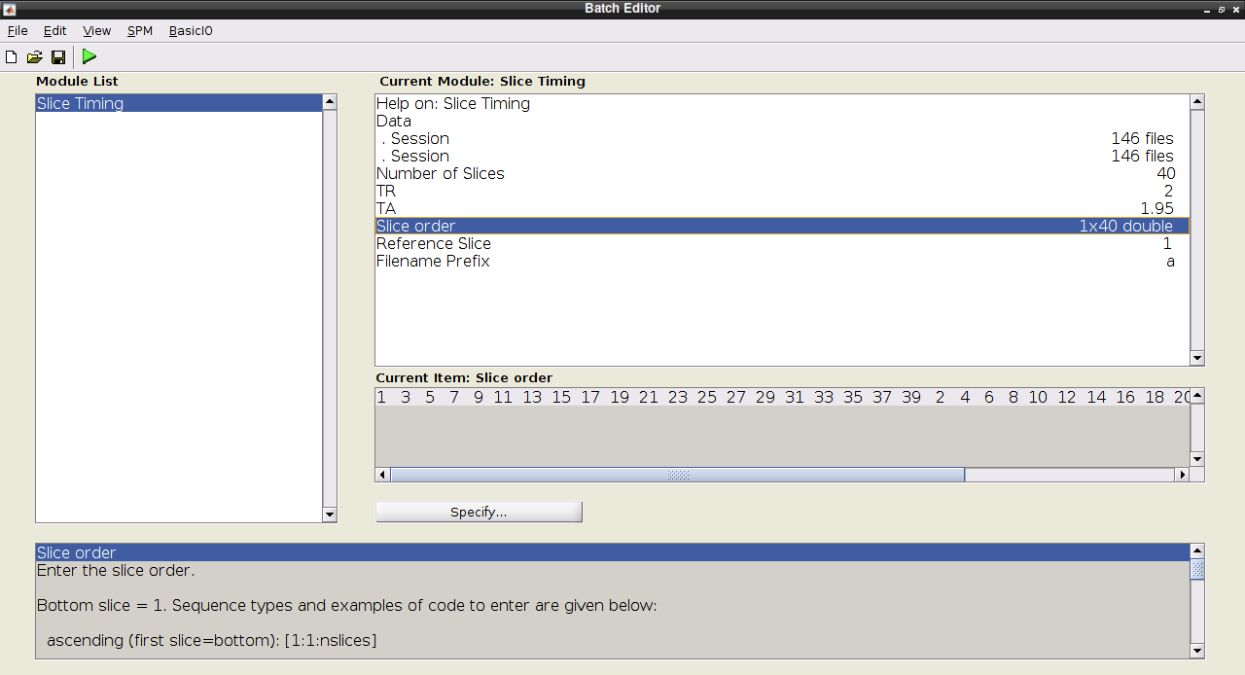 Slice timing configured for both runs