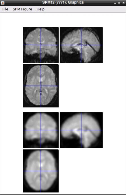 The same normalized volume before (top) and after (bottom) smoothing