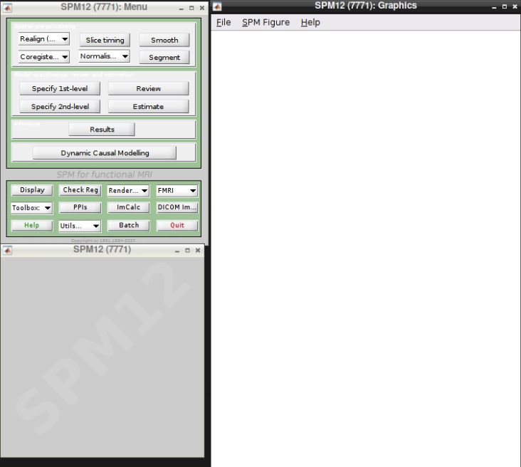 SPM Menu and Graphics windows
