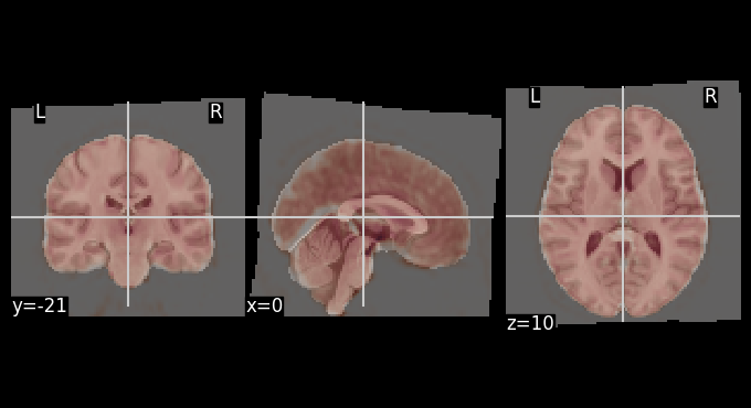 ../_images/0866e077bcaa7a3796c85432d3f371f0a18892ea761404969d9916a21c82fcfc.png