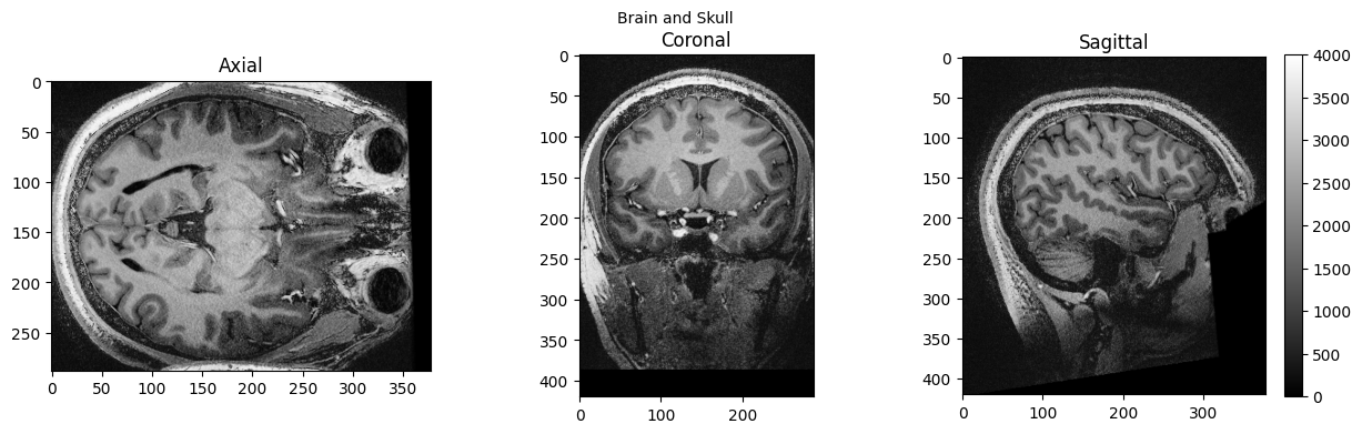 ../../_images/618baf2429cf73682b677e70a996b7931ebef85ca3165b501940566df10ce935.png