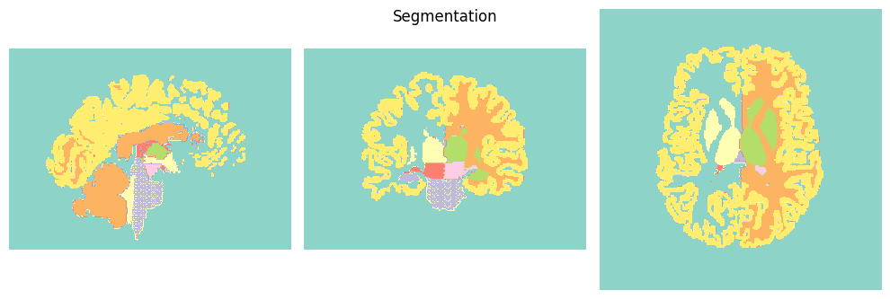../_images/64d07a66b65daca4990331d91acbf82aa9485e747598bf6f393275d279ab517f.png