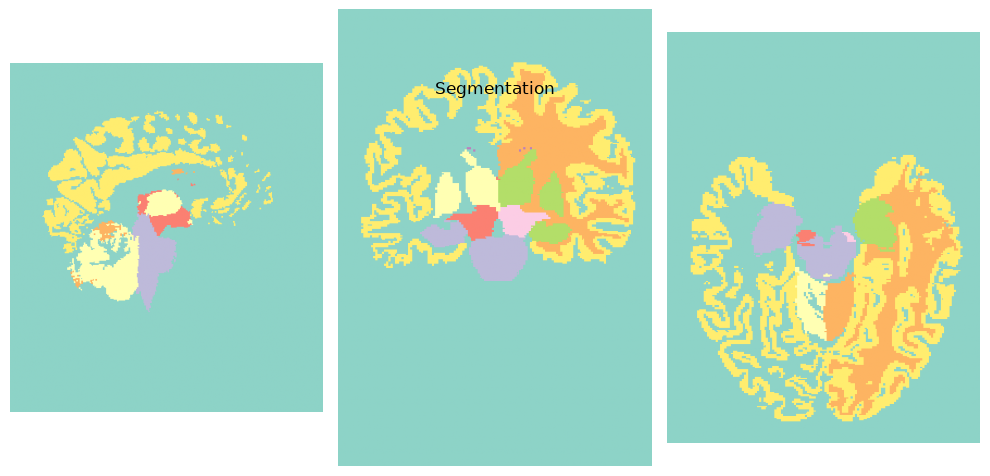 ../../_images/7c56faf7f7ad7814ab0ac15d601086ba9807cf8beb7f5219a658bd01e01805a4.png