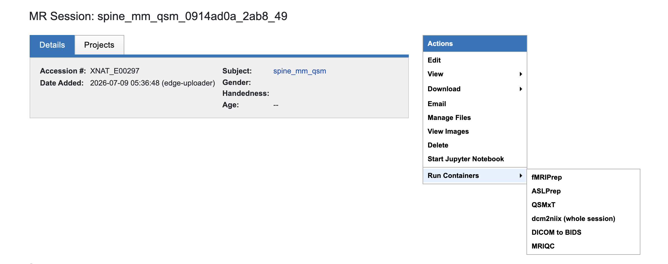 XNAT imaging session Actions menu showing session-level container pipelines